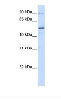 ZNF275 Antibody - 293T cell lysate. Antibody concentration: 1.0 ug/ml. Gel concentration: 12%.  This image was taken for the unconjugated form of this product. Other forms have not been tested.
