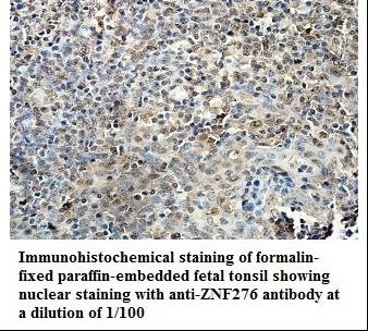 ZNF276 Antibody