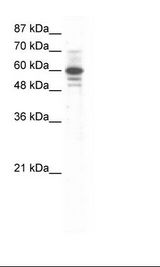 ZNF276 Antibody - HepG2 Cell Lysate.  This image was taken for the unconjugated form of this product. Other forms have not been tested.