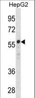 ZNF276 Antibody - ZNF276 Antibody western blot of HepG2 cell line lysates (35 ug/lane). The ZNF276 antibody detected the ZNF276 protein (arrow).