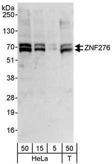 ZNF276 Antibody - Detection of Human ZNF276 by Western Blot. Samples: Whole cell lysate from HeLa (5, 15 and 50 ug) and 293T (T; 50 ug) cells. Antibodies: Affinity purified rabbit anti-ZNF276 antibody used for WB at 1 ug/ml. Detection: Chemiluminescence with an exposure time of 30 seconds.