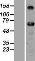 ZNF276 Protein - Western validation with an anti-DDK antibody * L: Control HEK293 lysate R: Over-expression lysate