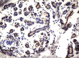 ZNF280A Antibody - IHC of paraffin-embedded Human breast tissue using anti-ZNF280A mouse monoclonal antibody. (Heat-induced epitope retrieval by 10mM citric buffer, pH6.0, 100C for 10min).