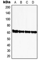 ZNF280A Antibody - Western blot analysis of ZNF280A expression in HeLa (A); Jurkat (B); NIH3T3 (C); rat kidney (D) whole cell lysates.