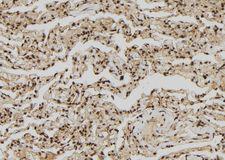 ZNF280A Antibody - 1:100 staining human lung tissue by IHC-P. The sample was formaldehyde fixed and a heat mediated antigen retrieval step in citrate buffer was performed. The sample was then blocked and incubated with the antibody for 1.5 hours at 22°C. An HRP conjugated goat anti-rabbit antibody was used as the secondary.