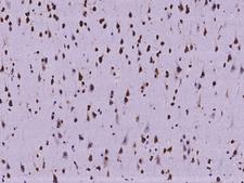 ZNF280A Antibody - Immunochemical staining of human ZNF280A in human brain with rabbit polyclonal antibody at 1:2000 dilution, formalin-fixed paraffin embedded sections.