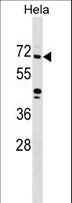 ZNF280B Antibody - ZNF280B Antibody western blot of HeLa cell line lysates (35 ug/lane). The ZNF280B antibody detected the ZNF280B protein (arrow).