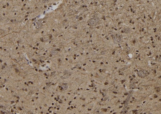 ZNF280B Antibody - 1:100 staining rat brain tissue by IHC-P. The sample was formaldehyde fixed and a heat mediated antigen retrieval step in citrate buffer was performed. The sample was then blocked and incubated with the antibody for 1.5 hours at 22°C. An HRP conjugated goat anti-rabbit antibody was used as the secondary.
