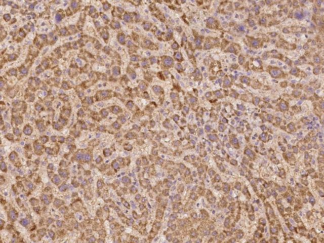 ZNF280B Antibody - Immunochemical staining of human ZNF280B in human liver with rabbit polyclonal antibody at 1:1000 dilution, formalin-fixed paraffin embedded sections.