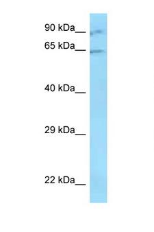 ZNF280B Antibody - ZNF280B / SUHW2 antibody Western blot of ACHN Cell lysate. Antibody concentration 1 ug/ml.  This image was taken for the unconjugated form of this product. Other forms have not been tested.