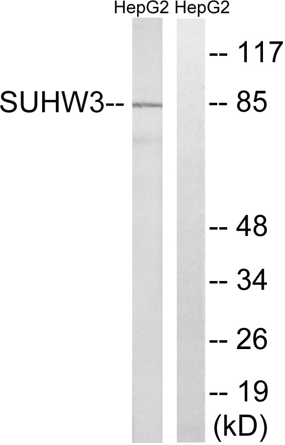 ZNF280C / SUHW3 Antibody - Western blot analysis of lysates from HepG2 cells, using ZNF280C Antibody. The lane on the right is blocked with the synthesized peptide.