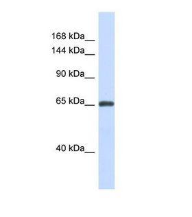 ZNF280D Antibody - Western blot of Human Fetal Brain. ZNF280D antibody dilution 1.0 ug/ml.  This image was taken for the unconjugated form of this product. Other forms have not been tested.