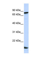 ZNF281 / Zfp281 Antibody - ZNF281 antibody Western blot of HeLa lysate. This image was taken for the unconjugated form of this product. Other forms have not been tested.