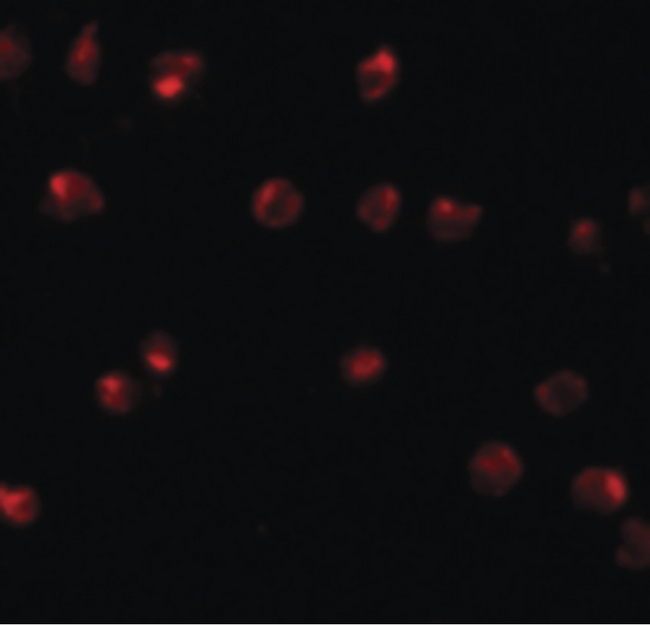 ZNF281 / Zfp281 Antibody - Immunofluorescence of ZFP291 in A20 cells with ZFP291 antibody at 20 ug/ml.