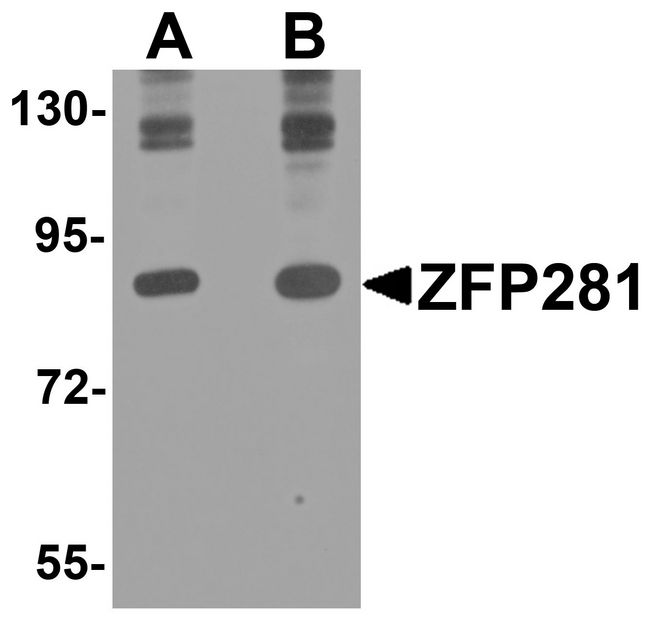 ZNF281 / Zfp281 Antibody - Western blot analysis of ZFP281 in A-20 cell lysate with ZFP281 antibody at (A) 0.25 and (B) 0.5 ug/ml.