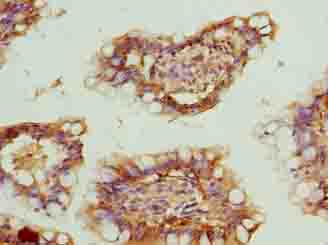 ZNF281 / Zfp281 Antibody - Immunohistochemistry of paraffin-embedded human small intestine tissue using antibody at dilution of 1:100.