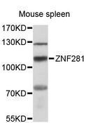 ZNF281 / Zfp281 Antibody - Western blot analysis of extracts of mouse spleen, using ZNF281 antibody at 1:3000 dilution. The secondary antibody used was an HRP Goat Anti-Rabbit IgG (H+L) at 1:10000 dilution. Lysates were loaded 25ug per lane and 3% nonfat dry milk in TBST was used for blocking. An ECL Kit was used for detection and the exposure time was 10s.