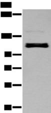 ZNF281 / Zfp281 Antibody - Western blot analysis of A549 cell  using ZNF281 Polyclonal Antibody at dilution of 1:250