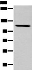 ZNF281 / Zfp281 Antibody - Western blot analysis of A549 cell  using ZNF281 Polyclonal Antibody at dilution of 1:600