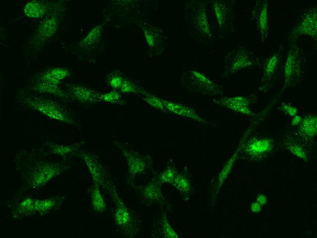 ZNF282 Antibody - Immunofluorescence staining of ZNF282 in U251MG cells. Cells were fixed with 4% PFA, permeabilzed with 0.1% Triton X-100 in PBS, blocked with 10% serum, and incubated with rabbit anti-Human ZNF282 polyclonal antibody (dilution ratio 1:100) at 4°C overnight. Then cells were stained with the Alexa Fluor 488-conjugated Goat Anti-rabbit IgG secondary antibody (green). Positive staining was localized to Nucleus and Cytoplasm.