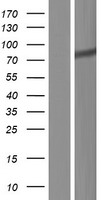 ZNF283 Protein - Western validation with an anti-DDK antibody * L: Control HEK293 lysate R: Over-expression lysate