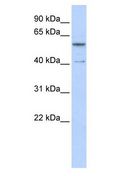 ZNF284 Antibody - ZNF284 antibody Western Blot of Human brain.  This image was taken for the unconjugated form of this product. Other forms have not been tested.
