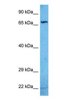 ZNF284 Antibody - Western blot of ZN284 Antibody with human Jurkat Whole Cell lysate.  This image was taken for the unconjugated form of this product. Other forms have not been tested.