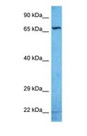 ZNF284 Antibody - Western blot of ZN284 Antibody with human Jurkat Whole Cell lysate.  This image was taken for the unconjugated form of this product. Other forms have not been tested.