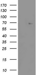 ZNF286A Antibody - HEK293T cells were transfected with the pCMV6-ENTRY control (Left lane) or pCMV6-ENTRY ZNF286A (Right lane) cDNA for 48 hrs and lysed. Equivalent amounts of cell lysates (5 ug per lane) were separated by SDS-PAGE and immunoblotted with anti-ZNF286A.