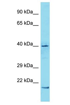 ZNF286A Antibody - ZNF286A antibody Western Blot of 786-0. Antibody dilution: 1 ug/ml.  This image was taken for the unconjugated form of this product. Other forms have not been tested.