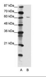 ZNF286A Antibody - A: Marker, B: Jurkat Cell Lysate.  This image was taken for the unconjugated form of this product. Other forms have not been tested.