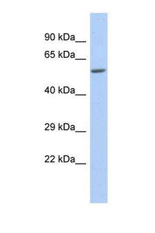 ZNF286B Antibody - Western blot of Human 721_B. ZNF286B antibody dilution 1.0 ug/ml.  This image was taken for the unconjugated form of this product. Other forms have not been tested.
