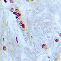ZNF287 Antibody - Immunohistochemical analysis of ZNF287 staining in human brain formalin fixed paraffin embedded tissue section. The section was pre-treated using heat mediated antigen retrieval with sodium citrate buffer (pH 6.0). The section was then incubated with the antibody at room temperature and detected using an HRP conjugated compact polymer system. DAB was used as the chromogen. The section was then counterstained with haematoxylin and mounted with DPX.