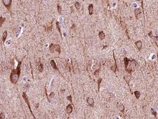 ZNF287 Antibody - 1:100 staining human brain tissue by IHC-P. The tissue was formaldehyde fixed and a heat mediated antigen retrieval step in citrate buffer was performed. The tissue was then blocked and incubated with the antibody for 1.5 hours at 22°C. An HRP conjugated goat anti-rabbit antibody was used as the secondary.