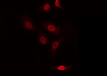 ZNF287 Antibody - Staining NIH-3T3 cells by IF/ICC. The samples were fixed with PFA and permeabilized in 0.1% Triton X-100, then blocked in 10% serum for 45 min at 25°C. The primary antibody was diluted at 1:200 and incubated with the sample for 1 hour at 37°C. An Alexa Fluor 594 conjugated goat anti-rabbit IgG (H+L) Ab, diluted at 1/600, was used as the secondary antibody.