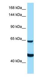 ZNF292 Antibody - ZNF292 antibody Western Blot of 293T.  This image was taken for the unconjugated form of this product. Other forms have not been tested.