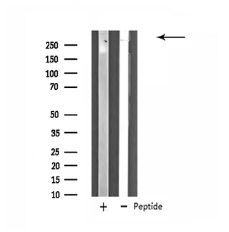 ZNF292 Antibody - Western blot analysis of extracts of HuvEc cells using ZNF292 antibody.