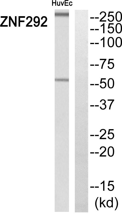 ZNF292 Antibody - Western blot analysis of extracts from HuvEc cells, using ZNF292 antibody.