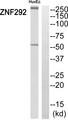 ZNF292 Antibody - Western blot analysis of extracts from HuvEc cells, using ZNF292 antibody.