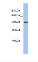 ZNF295 Antibody - Fetal muscle lysate. Antibody concentration: 1.0 ug/ml. Gel concentration: 6-18%.  This image was taken for the unconjugated form of this product. Other forms have not been tested.