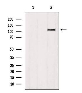 ZNF295 Antibody - Western blot analysis of extracts of HepG2 cells using ZNF295 antibody. Lane 1 was treated with the blocking peptide.