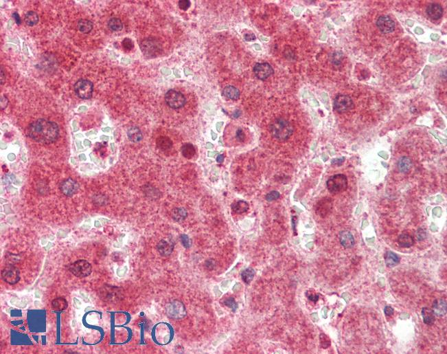 ZNF296 / ZNF342 Antibody - Anti-ZNF296 / ZNF342 antibody IHC staining of human liver. Immunohistochemistry of formalin-fixed, paraffin-embedded tissue after heat-induced antigen retrieval. Antibody concentration 5 ug/ml.  This image was taken for the unconjugated form of this product. Other forms have not been tested.