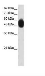 ZNF296 / ZNF342 Antibody - Transfected 293T Cell Lysate.  This image was taken for the unconjugated form of this product. Other forms have not been tested.