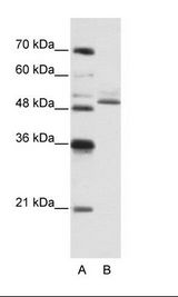 ZNF296 / ZNF342 Antibody - A: Marker, B: Jurkat Cell Lysate.  This image was taken for the unconjugated form of this product. Other forms have not been tested.