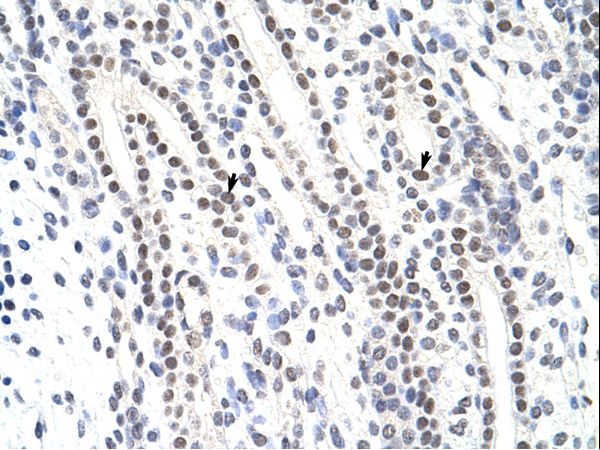 ZNF296 / ZNF342 Antibody - ZNF296 / ZNF342 antibody ARP39859_P050-NP_660331-ZNF342 (zinc finger protein 342) Antibody was used in IHC to stain formalin-fixed, paraffin-embedded human kidney.  This image was taken for the unconjugated form of this product. Other forms have not been tested.