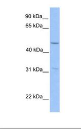ZNF296 / ZNF342 Antibody - HepG2 cell lysate. Antibody concentration: 1.0 ug/ml. Gel concentration: 12%.  This image was taken for the unconjugated form of this product. Other forms have not been tested.