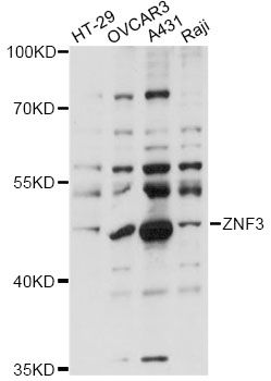 ZNF3 Antibody - Western blot analysis of extracts of various cell lines, using ZNF3 antibody at 1:1000 dilution. The secondary antibody used was an HRP Goat Anti-Rabbit IgG (H+L) at 1:10000 dilution. Lysates were loaded 25ug per lane and 3% nonfat dry milk in TBST was used for blocking. An ECL Kit was used for detection and the exposure time was 30s.