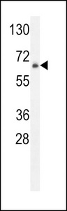 ZNF30 Antibody - ZNF30 Antibody western blot of HL-60 cell line lysates (35 ug/lane). The ZNF30 antibody detected the ZNF30 protein (arrow).