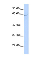 ZNF300 Antibody - ZNF300 antibody Western blot of Fetal liver lysate. This image was taken for the unconjugated form of this product. Other forms have not been tested.