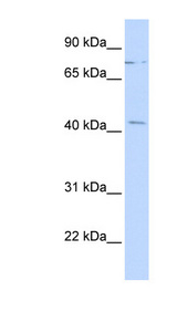 ZNF302 Antibody - ZNF302 antibody Western blot of Fetal lung lysate. This image was taken for the unconjugated form of this product. Other forms have not been tested.